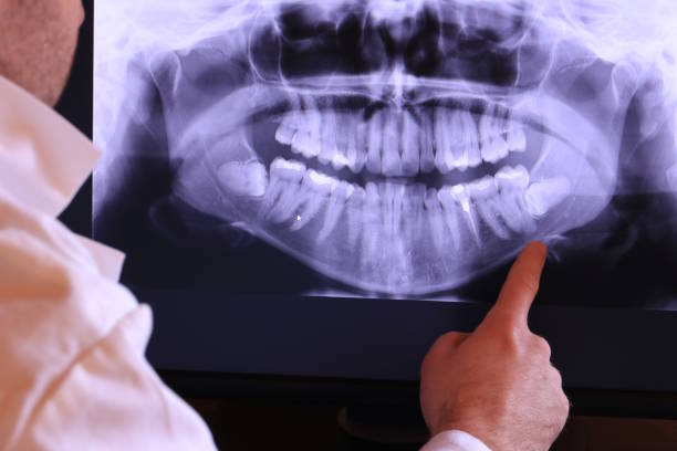 Best Emergency Dentist for Lost Fillings or Crowns in Port Orange, FL